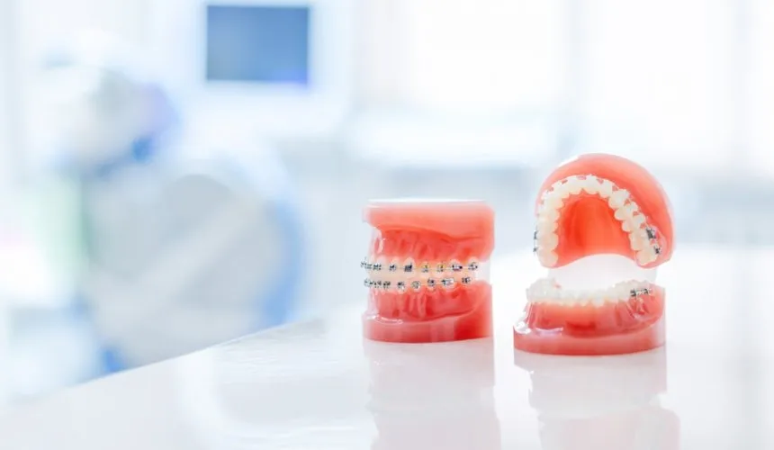 Ortodonti Tedavileri Hangi Problemler İçin Yapılır?