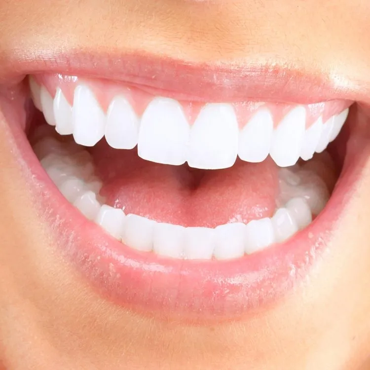 Kullandığımız Diş Beyazlatma Yöntemleri Nelerdir?