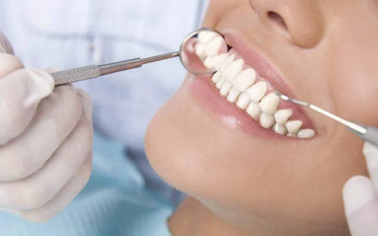 Diş Dolgusu Tedavilerinde Kullanılan Çeşitler Nelerdir?